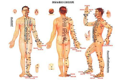 acupuncture poster tin Metal Print Wall Art